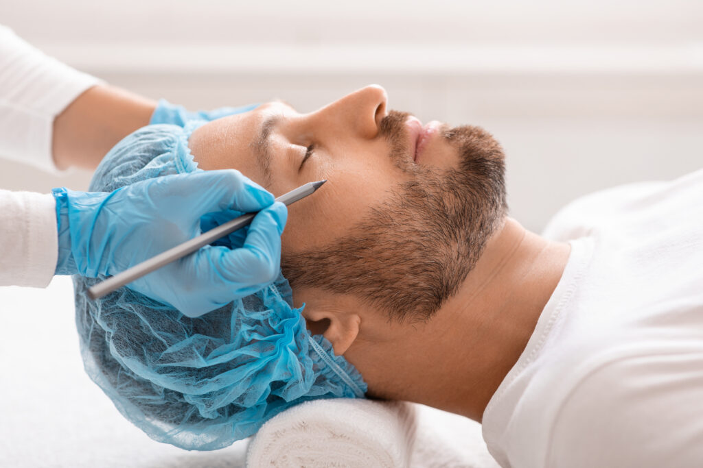 Knappe man krijgt potloodstrepen onder zijn ogen voor een operatie